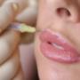 Lippen aufspritzen