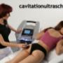 cavitation kavitation cavitation kavitation