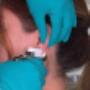 Professionelles Ohrlochstechen mit dem STUDEX System bei Juwelier Wilmsen Wien 1020, sanft und sicher