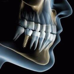 Zahn4me Dentallabor-Ettenauer Gesellschaft m.b.H.
