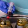 ACP-Therapie
Autologes Conditioniertes Plasma