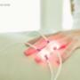 Laser-Therapie