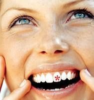 Eltz Institut für Zahnregulierung, Zahnspangen & Invisalign