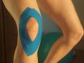 Knie-Tape