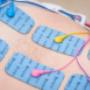Elektrotherapie