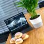 EDELWEISS Digital_Standort Seiersberg_Krapfen
