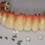 Pro Dentes Zahntechnisches Meisterlabor ZTM Markus Gapp