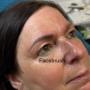 Facebrush_Microblading