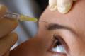 BOTOX-  EVERGREEN DER SCHÖNHEITSMEDIZIN..
