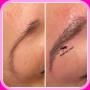 Diamant Nano Blading