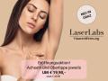 Die Schritte einer Laser-Haarentfernung bei LaserLabs