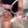 T-Shape Gesicht Behandlung