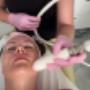 T-Shape Gesicht Behandlung
