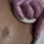 T- Shape Bauch Behandlung